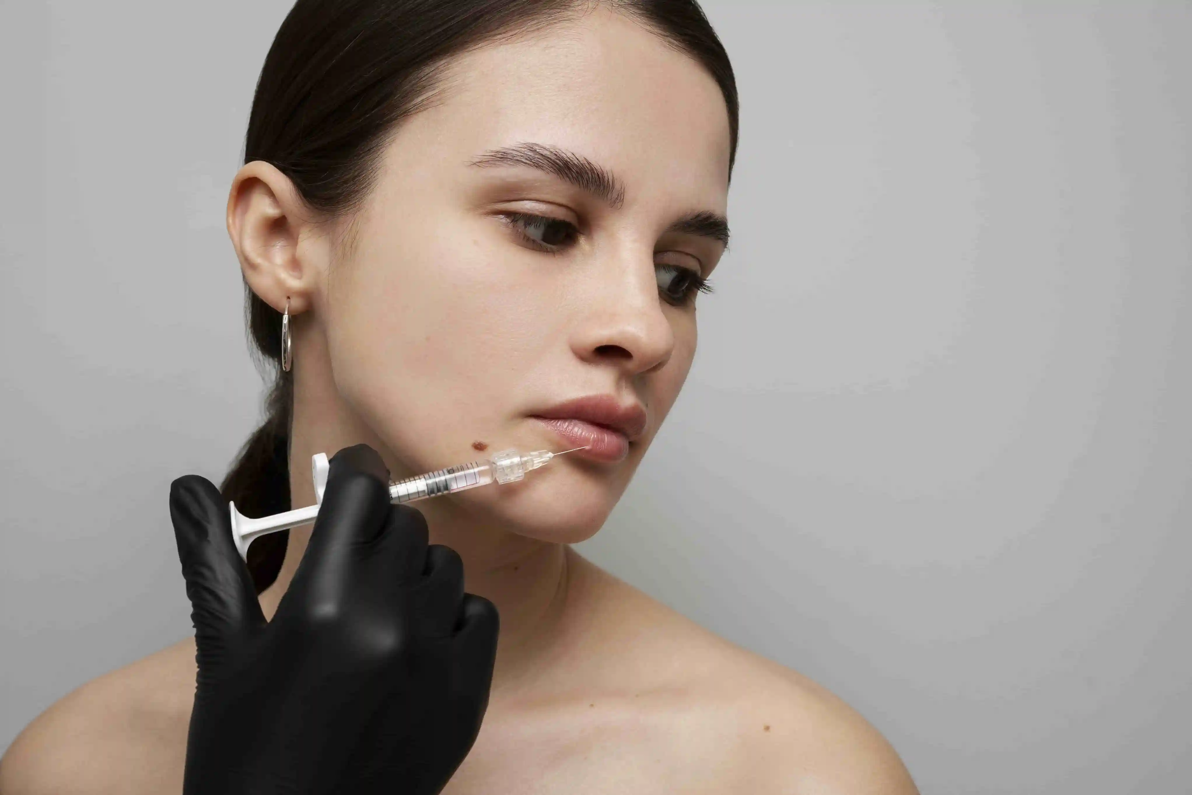 how to prepare for dermal filler treatment