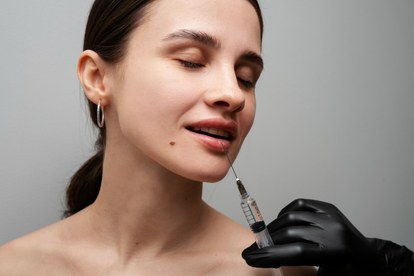 lip filler swelling stages