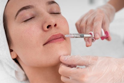 kissing after lip filler safe timing explained