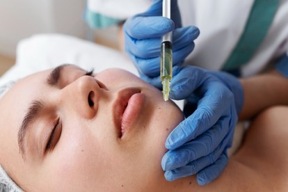 white spots on lips after filler explained